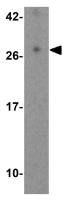 EBI3 antibody