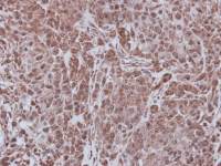 FBL4 antibody [C1C3]