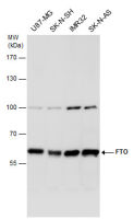 FTO antibody