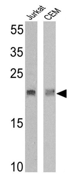 TCR V delta 2 antibody [15D]