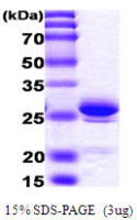 Human HMGB1 protein, His tag
