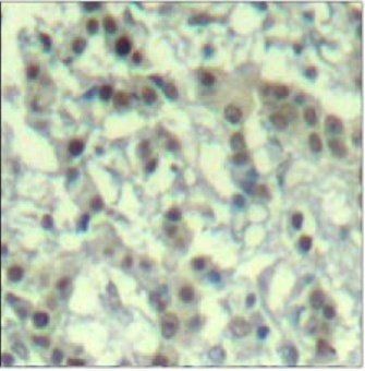 Aurora A (phospho Thr288) antibody