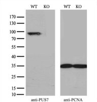 PUS7 antibody [4C6]