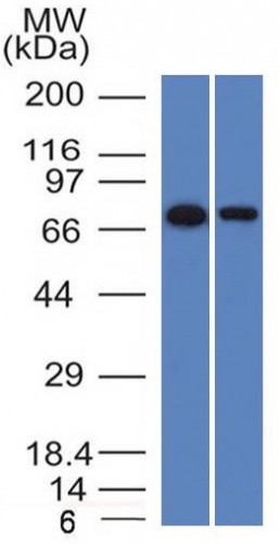 CD105 antibody [ENG/1327]