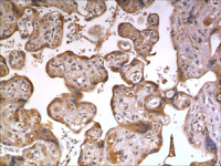 IL20 Receptor alpha antibody [9F40]
