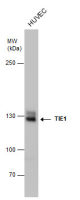 TIE1 antibody