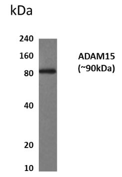 ADAM15 antibody [9H34]