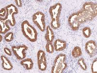 PSA antibody [IHC654]