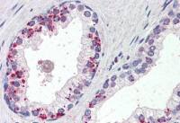 Annexin A1 antibody, C-term