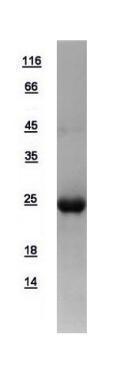Human Beta A4 Crystallin protein, His tag产品图