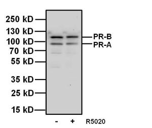 Progesterone Receptor antibody [Alpha PR6]