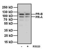 Progesterone Receptor antibody [Alpha PR6]