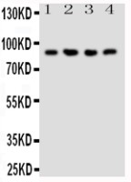 NRG2 antibody