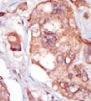 TNK1 antibody, Internal