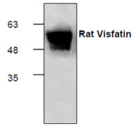 Human Neurotrophin 4 protein (active)