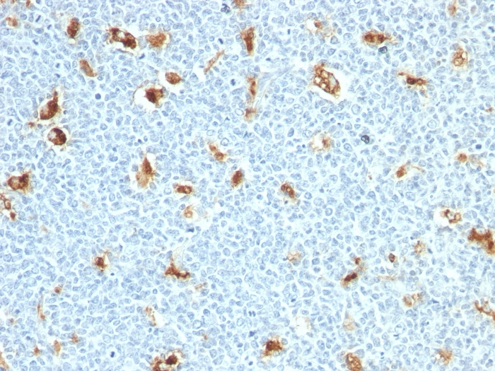 S100A9 antibody [S100A9/1011]