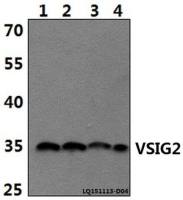 VSIG2 antibody