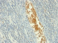 AMPD3 antibody [AMPD3/901]