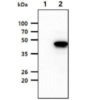 SERPINA12 antibody [1C4]