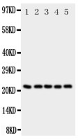 SDC2 antibody