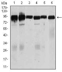 TGF beta Receptor III antibody [1C5H11]