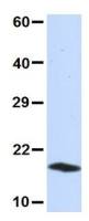 UBE2D3 antibody, N-term