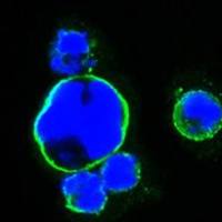 Islet 1 antibody [1H9]