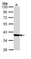 Cortisol Binding Globulin antibody [N2C3]