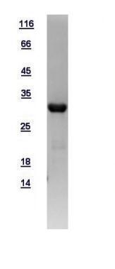 Human BCL10 protein, His tag