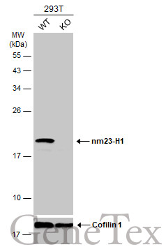 nm23-H1 antibody [N1C3]