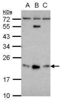 GLIPR1L1 antibody