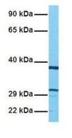 Adenine Nucleotide Translocase 1 antibody, N-term