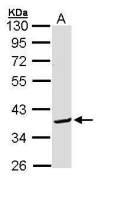 BCL2L12 antibody