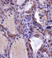 NIS antibody