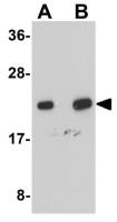 NDUFB9 antibody