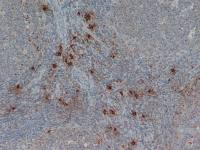 Mast cell tryptase antibody [AA1]