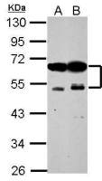 ZFYVE19 antibody