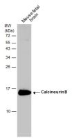 Calcineurin B antibody