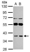 LANCL1 antibody