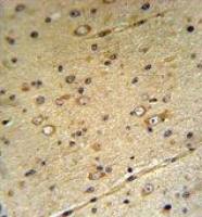 ZIP3 antibody, Internal