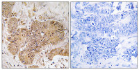 LUC7L2 antibody