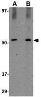 SIRT2 antibody
