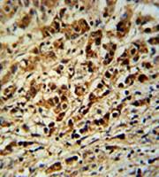 AVL9 antibody