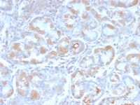 TFF1 antibody [TFF1/2969R]