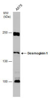 Desmoglein 1 antibody