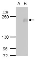 FIP200 antibody