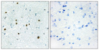 DCLK3 antibody