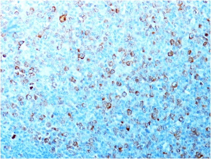 CDC2 antibody [CDK1/873]