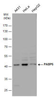PABPC5 antibody [N1C2]