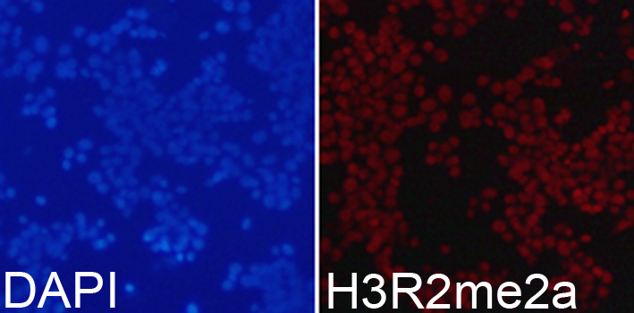 Histone H3R2me2 (Asymmetric Di-methyl Arg2) antibody